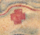 Tattoos - Betty Page Nurse (Detail Shot) - 41754